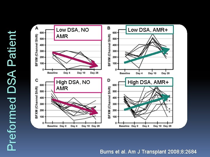 Preformed DSA Patient Low DSA, NO AMR Low DSA, AMR+ High DSA, NO AMR