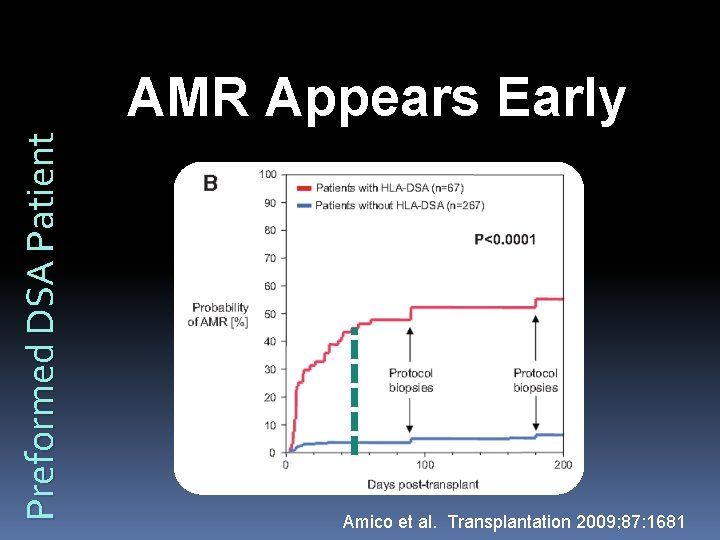 Preformed DSA Patient AMR Appears Early Amico et al. Transplantation 2009; 87: 1681 