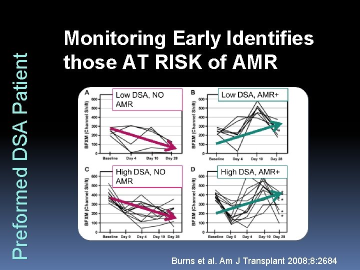 Preformed DSA Patient Monitoring Early Identifies those AT RISK of AMR Burns et al.