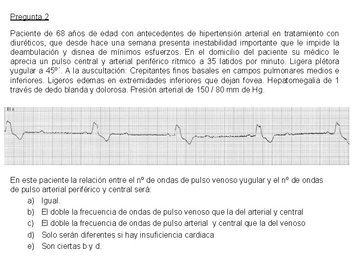 Pregunta 2 Paciente de 68 años de edad con antecedentes de hipertensión arterial en