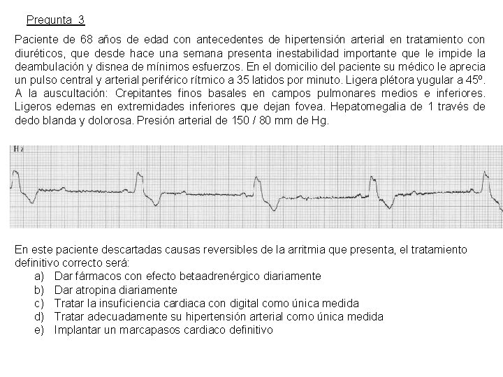 Pregunta 3 Paciente de 68 años de edad con antecedentes de hipertensión arterial en