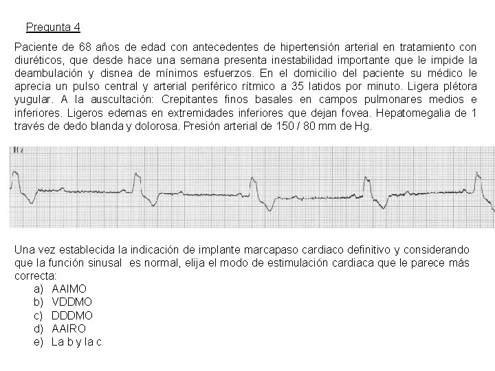 Pregunta 4 Paciente de 68 años de edad con antecedentes de hipertensión arterial en