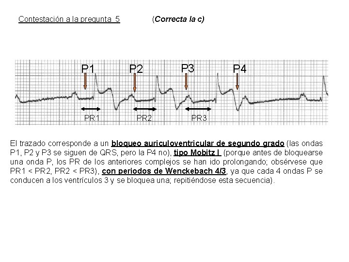 Contestación a la pregunta 5 P 1 PR 1 (Correcta la c) P 2