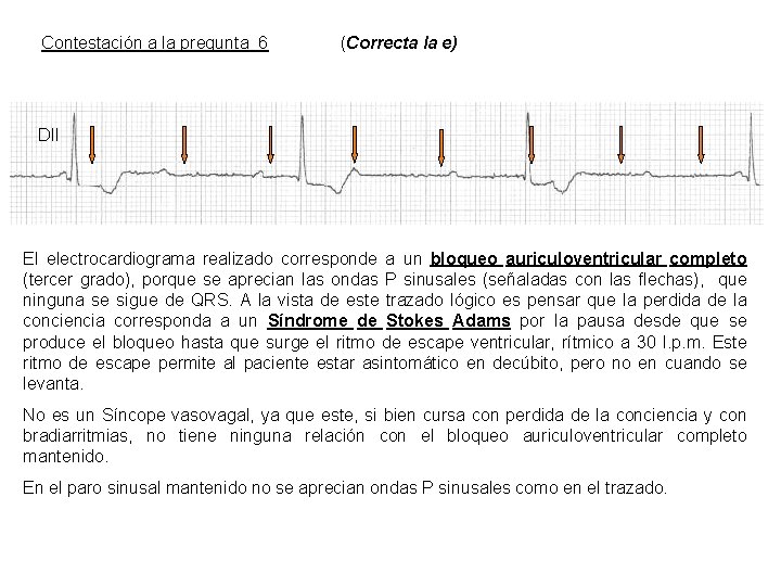 Contestación a la pregunta 6 (Correcta la e) DII El electrocardiograma realizado corresponde a