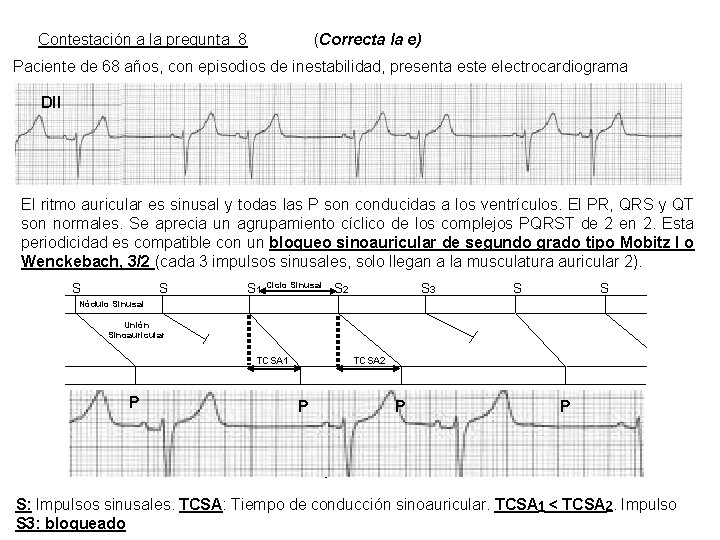 Contestación a la pregunta 8 (Correcta la e) Paciente de 68 años, con episodios