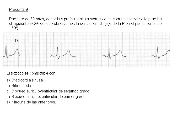 Pregunta 9 Paciente de 30 años, deportista profesional, asintomático, que en un control se
