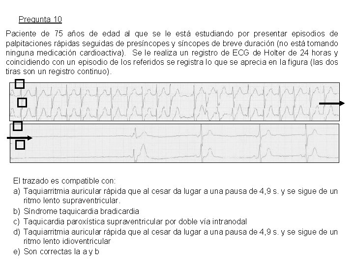 Pregunta 10 Paciente de 75 años de edad al que se le está estudiando