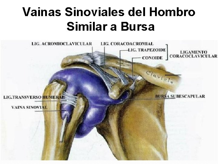 Vainas Sinoviales del Hombro Similar a Bursa 