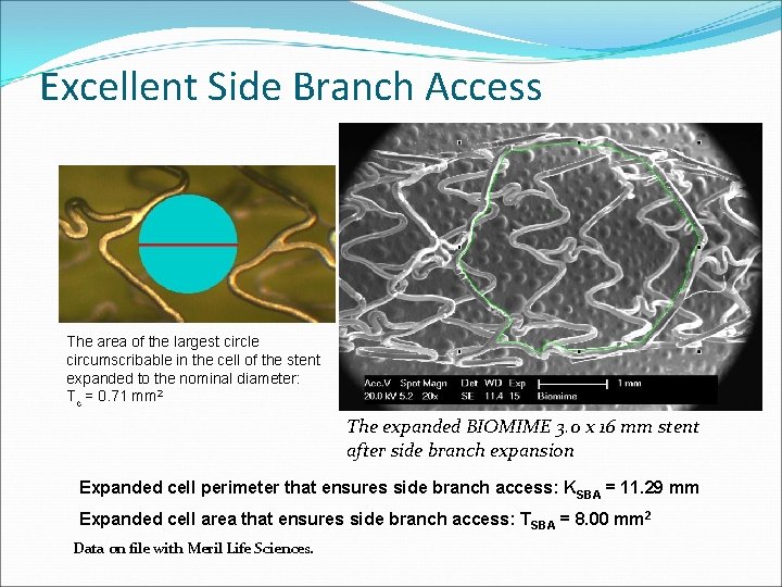 Excellent Side Branch Access The area of the largest circle circumscribable in the cell