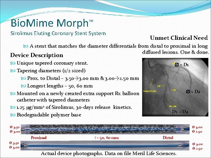Bio. Mime Morph TM Sirolimus Eluting Coronary Stent System Unmet Clinical Need A stent