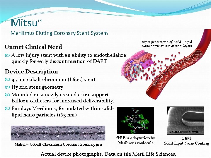 Mitsu TM Merilimus Eluting Coronary Stent System Rapid penetration of Solid – Lipid Nano