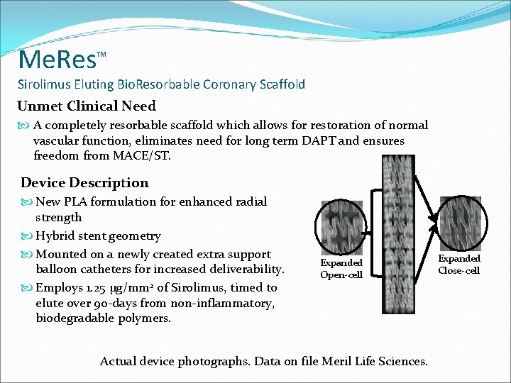 Me. Res TM Sirolimus Eluting Bio. Resorbable Coronary Scaffold Unmet Clinical Need A completely
