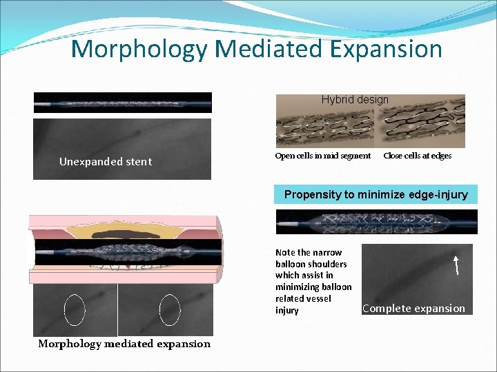 Morphology Mediated Expansion Hybrid design Unexpanded stent Open cells in mid segment Close cells