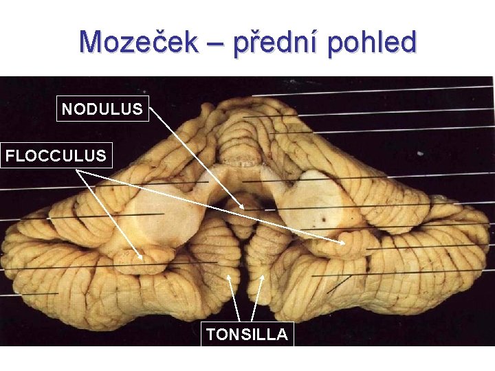 Mozeček – přední pohled NODULUS FLOCCULUS TONSILLA 
