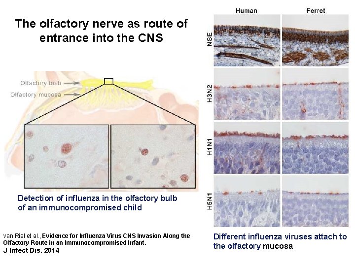 The olfactory nerve as route of entrance into the CNS Detection of influenza in