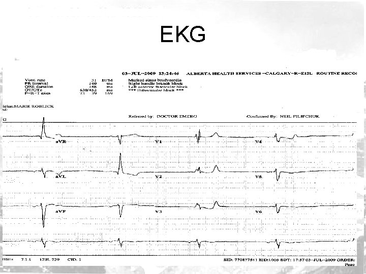 EKG 