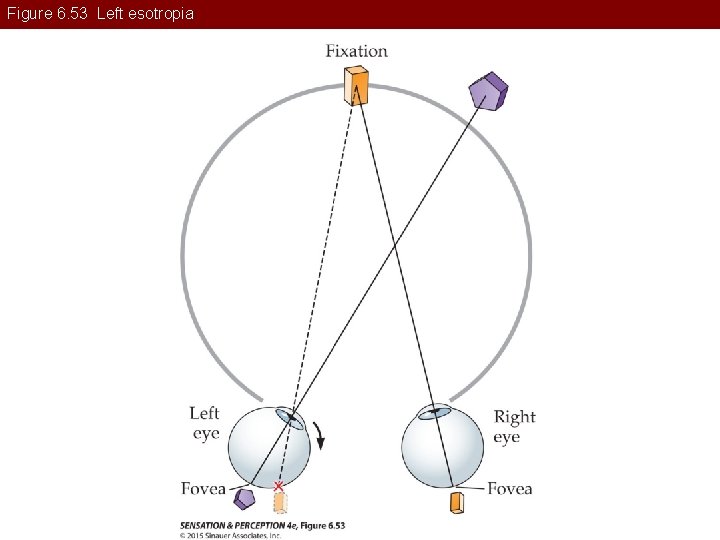 Figure 6. 53 Left esotropia 