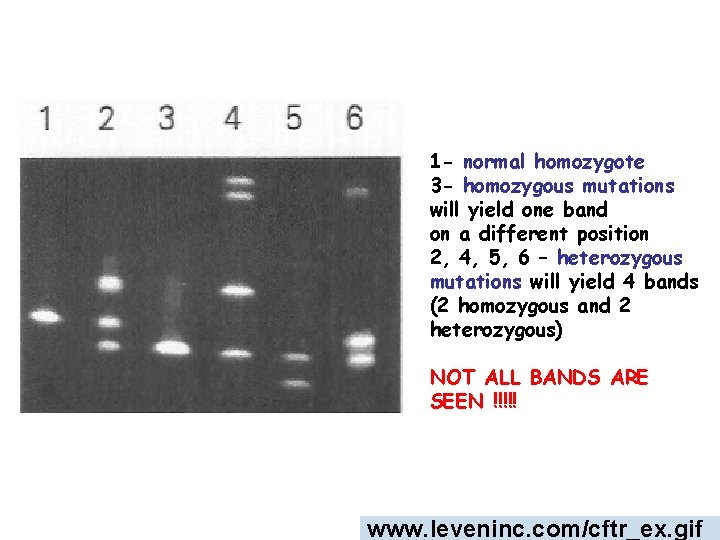 1 - normal homozygote 3 - homozygous mutations will yield one band on a