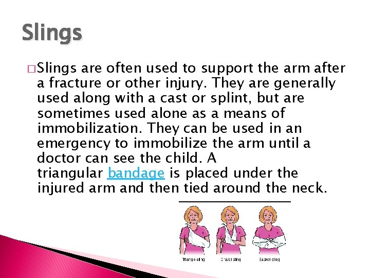 Slings � Slings are often used to support the arm after a fracture or Slings � Slings are often used to support the arm after a fracture or