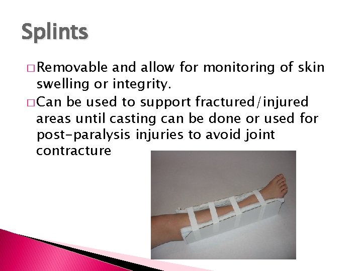 Splints � Removable and allow for monitoring of skin swelling or integrity. � Can Splints � Removable and allow for monitoring of skin swelling or integrity. � Can