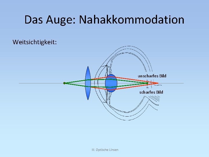 Das Auge: Nahakkommodation Weitsichtigkeit: unscharfes Bild III. Optische Linsen 