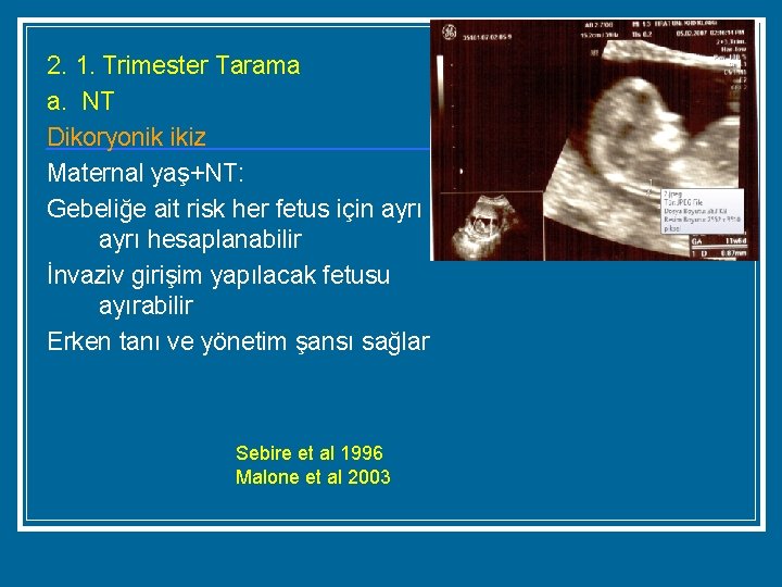 2. 1. Trimester Tarama a. NT Dikoryonik ikiz Maternal yaş+NT: Gebeliğe ait risk her