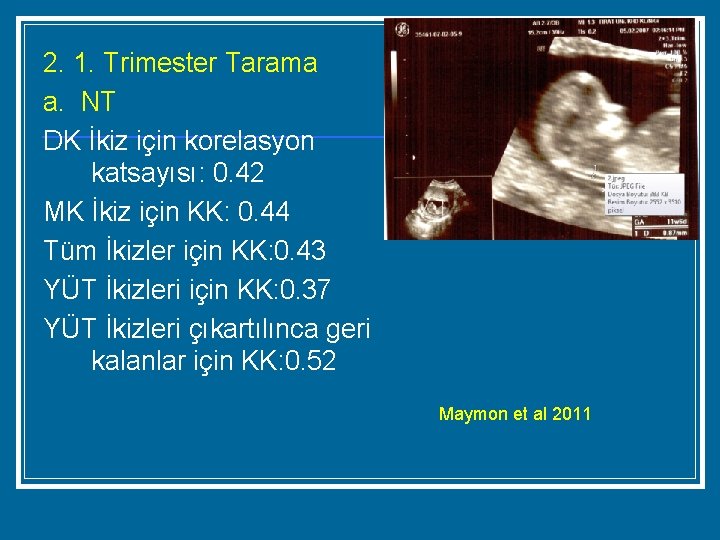 2. 1. Trimester Tarama a. NT DK İkiz için korelasyon katsayısı: 0. 42 MK