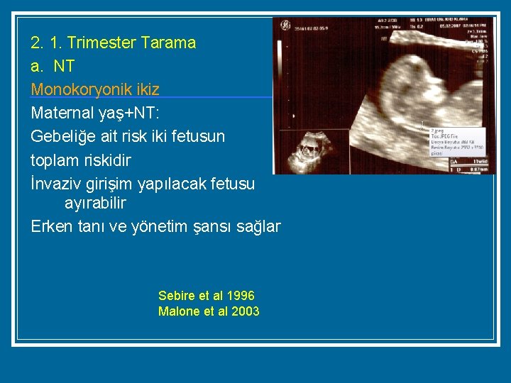 2. 1. Trimester Tarama a. NT Monokoryonik ikiz Maternal yaş+NT: Gebeliğe ait risk iki