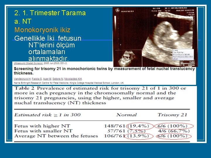 2. 1. Trimester Tarama a. NT Monokoryonik ikiz Genellikle İki fetusun NT’lerini ölçüm ortalamaları