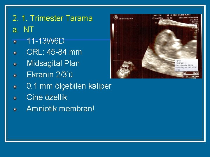 2. 1. Trimester Tarama a. NT 11 -13 W 6 D CRL: 45 -84