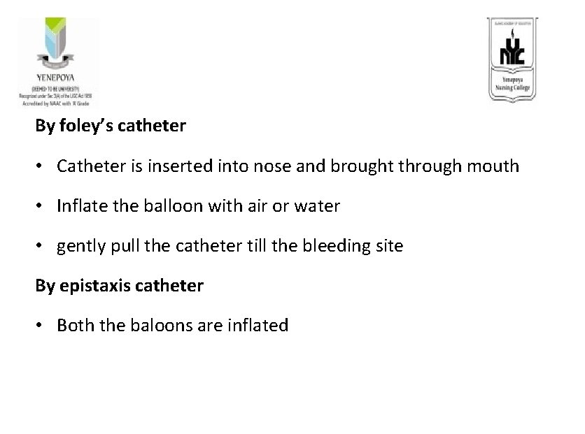 By foley’s catheter • Catheter is inserted into nose and brought through mouth •