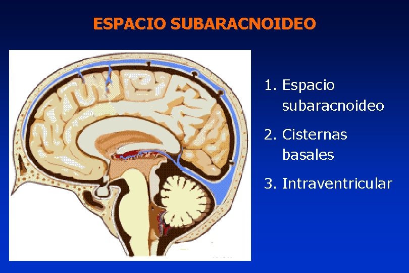 ESPACIO SUBARACNOIDEO 1. Espacio subaracnoideo 2. Cisternas basales 3. Intraventricular 