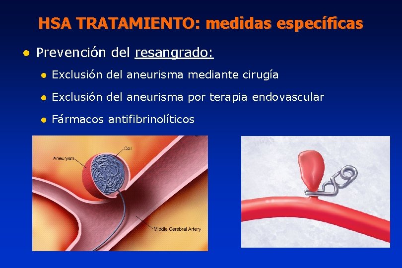 HSA TRATAMIENTO: medidas específicas l Prevención del resangrado: l Exclusión del aneurisma mediante cirugía