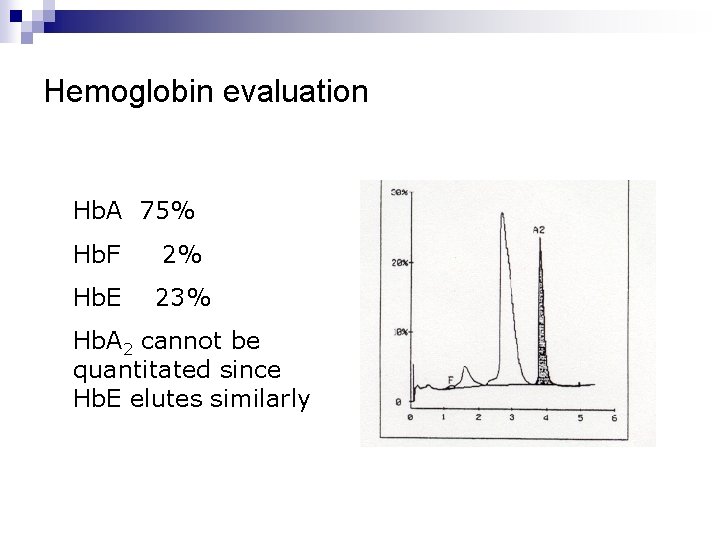 Hemoglobin evaluation Hb. A 75% Hb. F 2% Hb. E 23% Hb. A 2