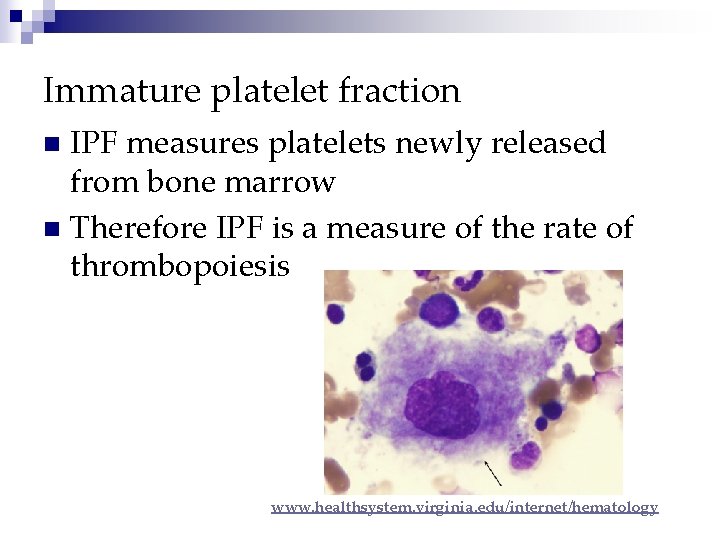 Immature platelet fraction IPF measures platelets newly released from bone marrow n Therefore IPF