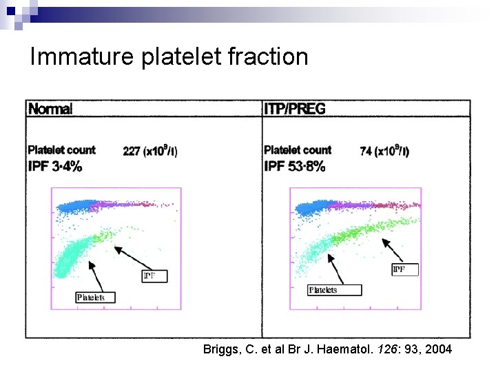 Immature platelet fraction Briggs, C. et al Br J. Haematol. 126: 93, 2004 
