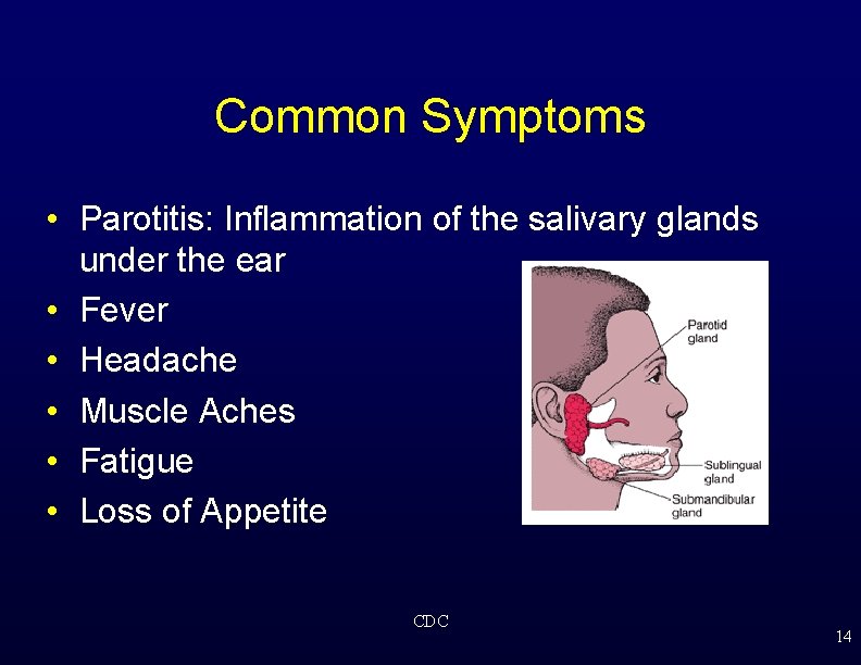 Common Symptoms • Parotitis: Inflammation of the salivary glands under the ear • Fever