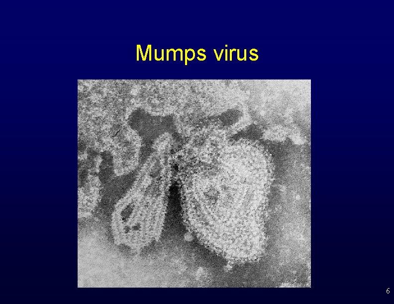 Mumps virus 6 