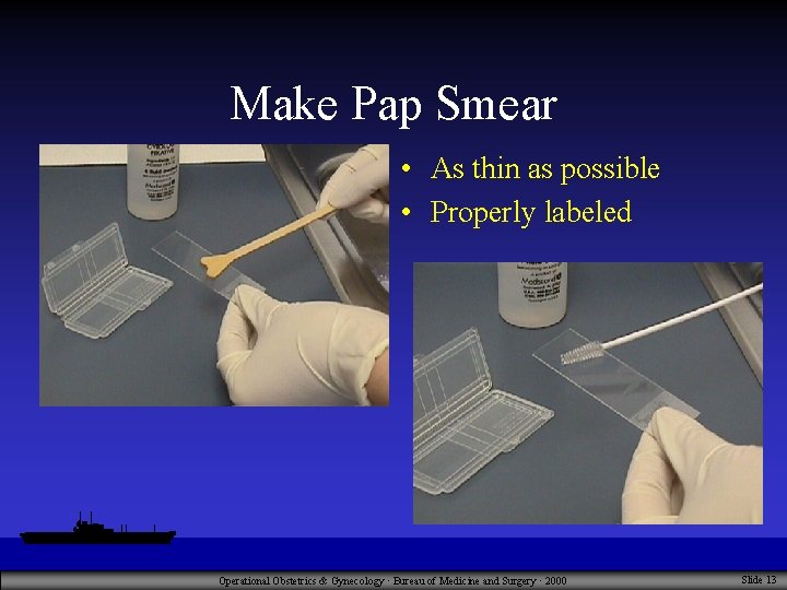 Pap Smear Technique Video Operational Obstetrics Gynecology Bureau