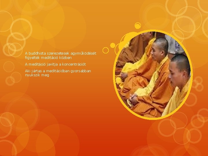 A buddhista szerezetesek agyműködését figyelték meditáció közben A meditáció javitja a koncentrációt Aki jártas