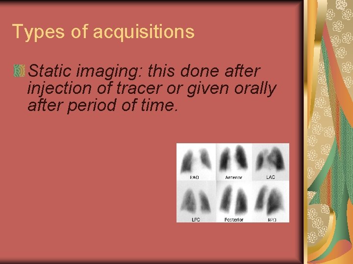 Types of acquisitions Static imaging: this done after injection of tracer or given orally