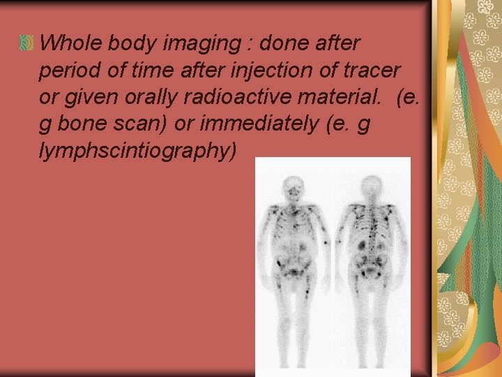 Whole body imaging : done after period of time after injection of tracer or