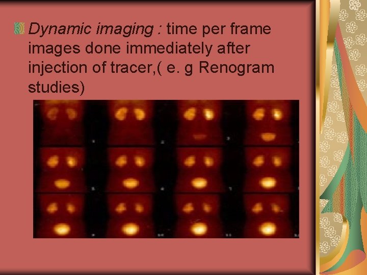 Dynamic imaging : time per frame images done immediately after injection of tracer, (