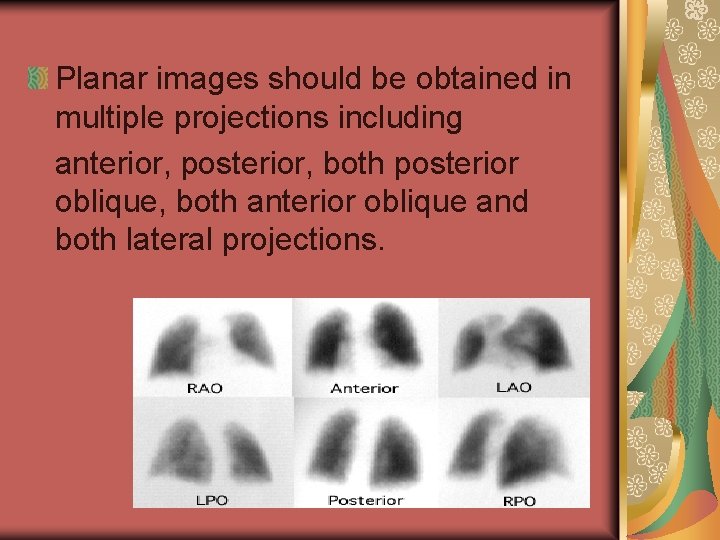 Planar images should be obtained in multiple projections including anterior, posterior, both posterior oblique,