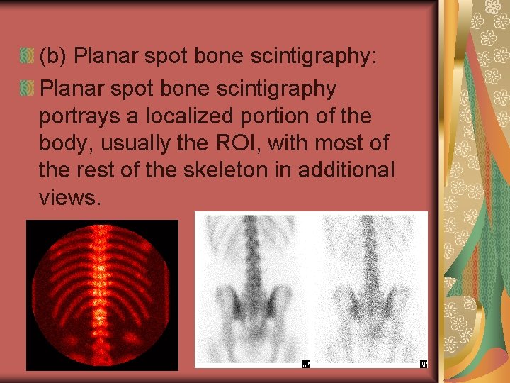 (b) Planar spot bone scintigraphy: Planar spot bone scintigraphy portrays a localized portion of