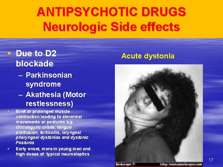 ANTIPSYCHOTIC DRUGS Neurologic Side effects § Due to D 2 blockade Acute dystonia –