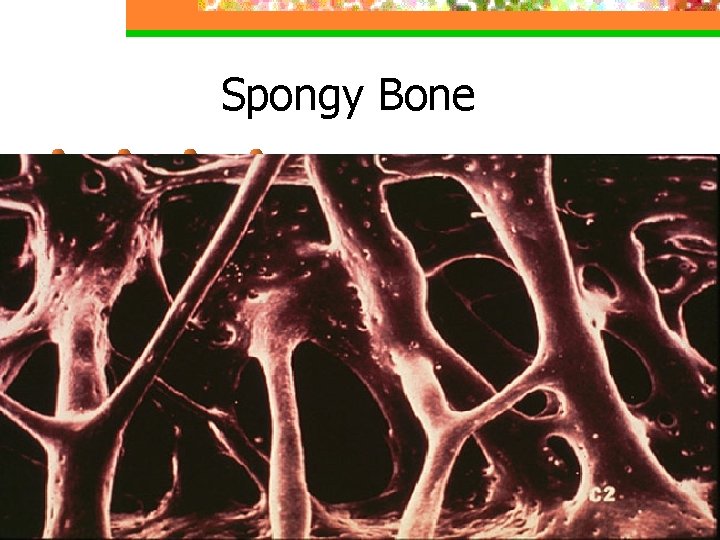 Spongy Bone 