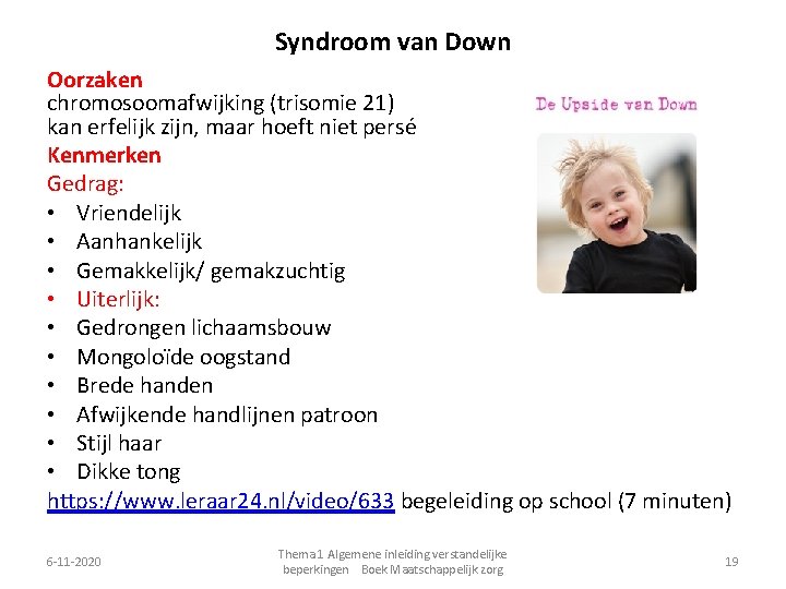 Syndroom van Down Oorzaken chromosoomafwijking (trisomie 21) kan erfelijk zijn, maar hoeft niet persé