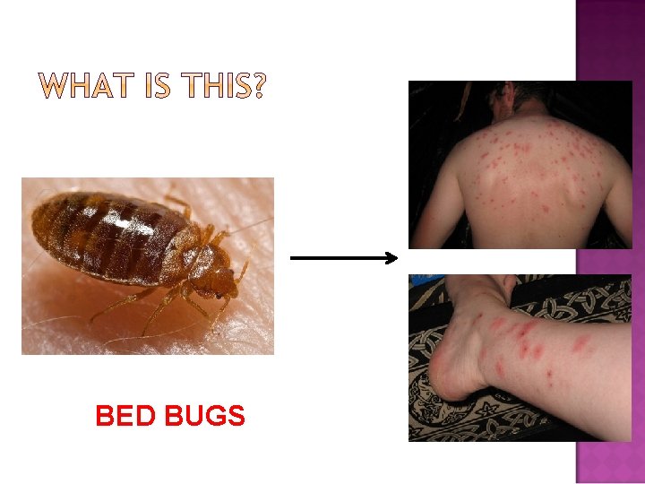 BED BUGS 