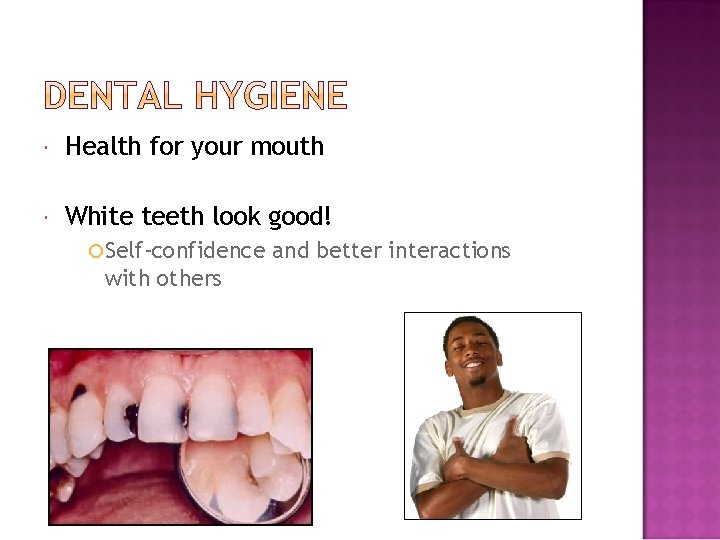  Health for your mouth White teeth look good! Self-confidence with others and better